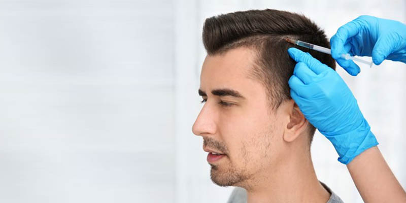 All you need to know about Hair Transplant